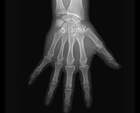 Trauma Radiography | Imaging & X-Ray Machine